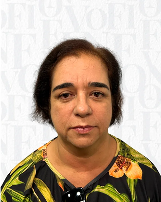 A mesma paciente depois do transplante capilar FUE